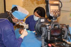 جراحي سينوس ليفت توسط دكتر وفا مشيرآبادی