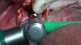 4-5-Mehr-98-Live-Surgery_3