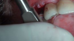 4-5-Mehr-98-Live-Surgery_6