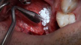 GBR - Course - 2019_8