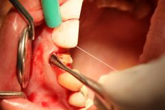 18 th International congress of Iranian association of oral and maxillofacial surgeons_15