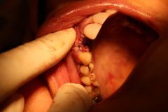 جراحی آقای دكتر غلامی