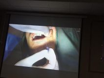 Implant and GBR course in Hamedan_13