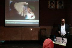 SPI surgical and prosthetic procedures