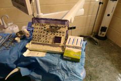 SPI system presentation with live surgery