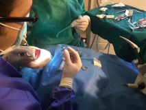 PeriAcryl tissue adhesive practical training with Live surgery