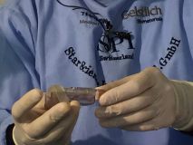 SPI system presentation with live surgery_11